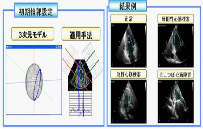 WS`󃂃f̓KpɂSǗ֊so@